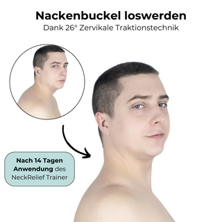 Neckrelief Trainer - Nackenbuckel los werden oder Geld zurück